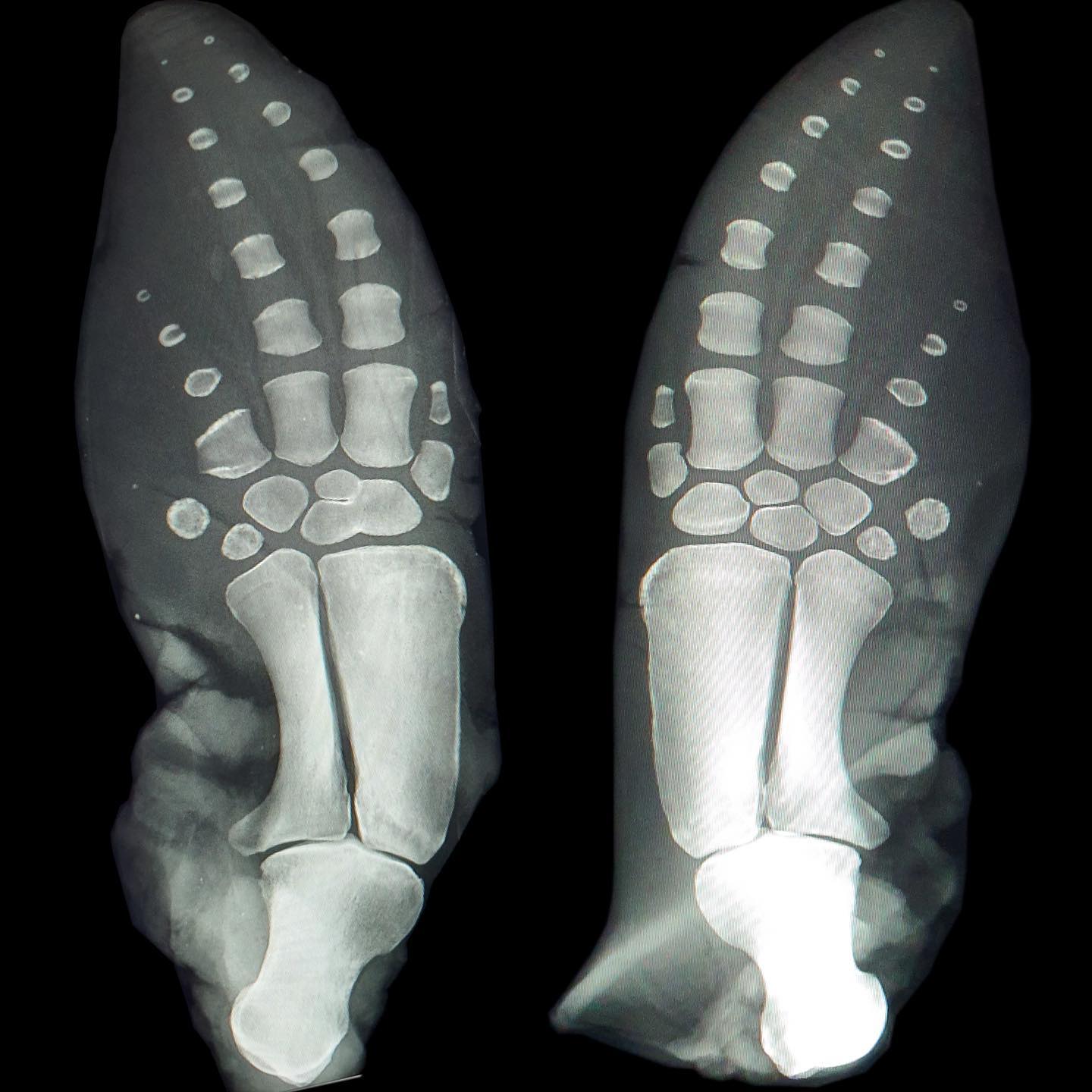 X-ray of whale flippers showing finger bones (phalanges), wrist bones (carpals), forearm bones (radius and ulna), and upper arm bone (humerus) - the same bone pattern found in human arms